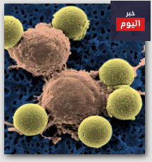 مضاد حيوي يقلل وفيات الإيدز