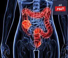 نزف المستقيم - Rectal Bleeding
