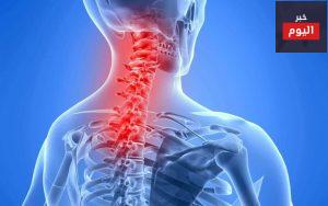 آلام الرقبة - Neck Pain