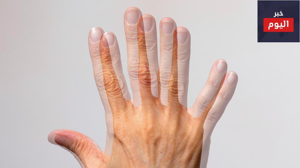 ازدواجية الرؤية - Diplopia