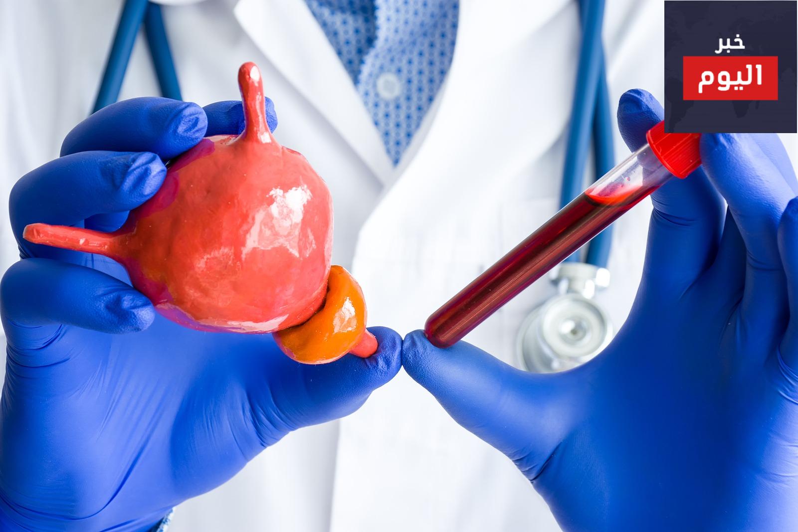 هل يجب أن أقوم باختبار المستضدّ البروستاتي النوعي؟ - Should I have a PSA test?