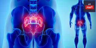 التهاب المفاصل الروماتويدي - Rheumatoid Arthritis