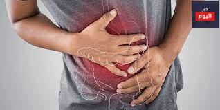 الإمساك - Constipation