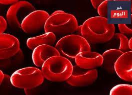 التلاسيميا - Thalassaemia