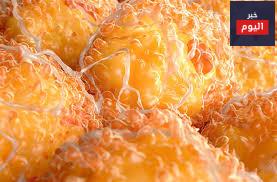 الدهون: حقائق - Fat: The facts