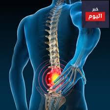 ألم العصب الوركي / عرق النسا - Sciatica