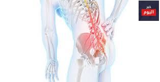 التهاب الفقار اللاصق - Ankylosing spondylitis