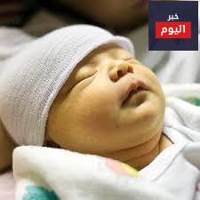 اليرقان - Jaundice
