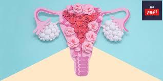 متلازمة تكيّس المبايض - PCOS