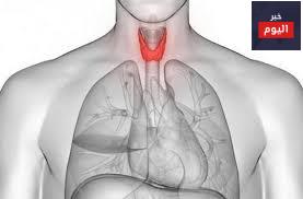 فرط نشاط الغده الدرقية - Hyperthyroidism