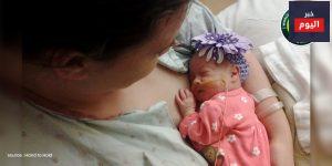 إرضاع الأطفال الخدج - Breastfeeding a premature baby