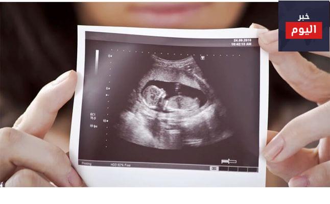 الفحص الأول بالموجات ما فوق الصوتية (السونار)