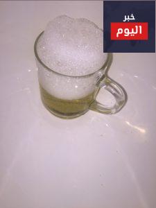 تحليل الحمل بالكلور