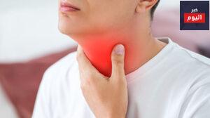 علاج احتقان الحلق
