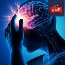 أسباب الصرع