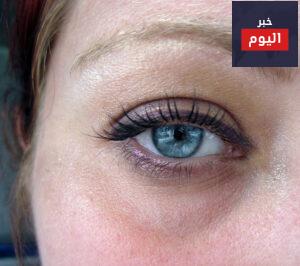 كيفية إزالة الهالات السوداء