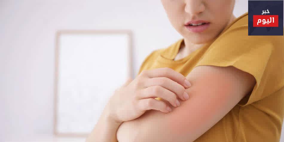 أعراض الإيدز ومتى تظهر