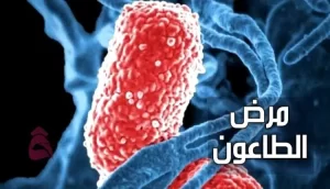 نبذة عن Plague epidemic مرض الطاعون