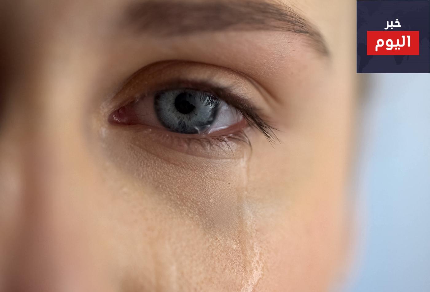 تعرف على الفوائد الأربع للبكاء لصحة البشرة وجمالها