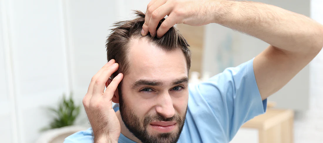 علاج تساقط الشعر للرجال