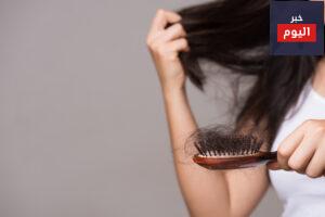 علاج تساقط الشعر بشكل غير طبيعي