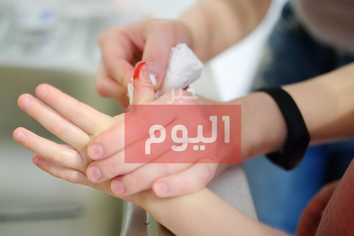 طريقة تعقيم الجروح في المنزل